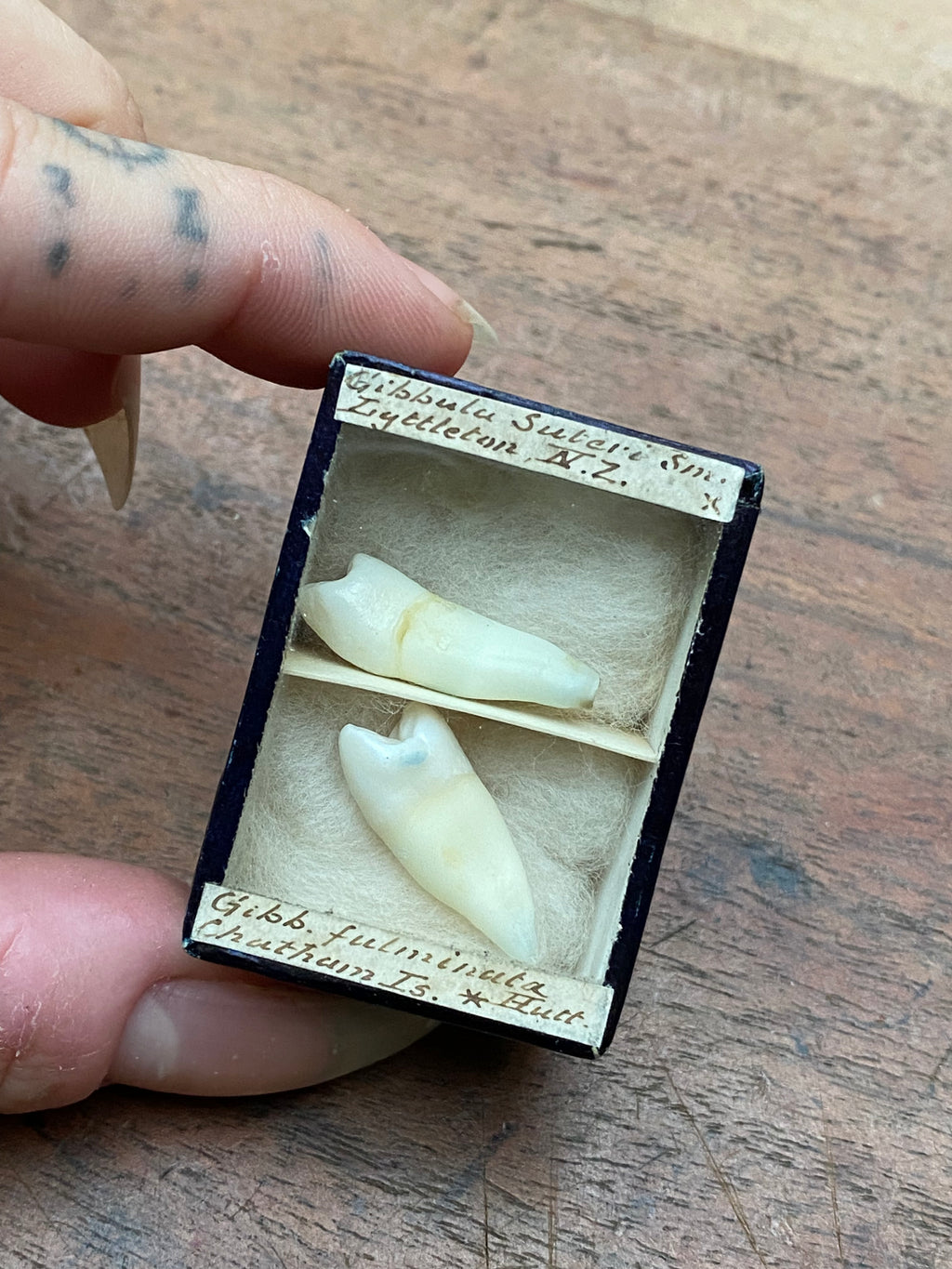 Vintage Human Teeth Display Box