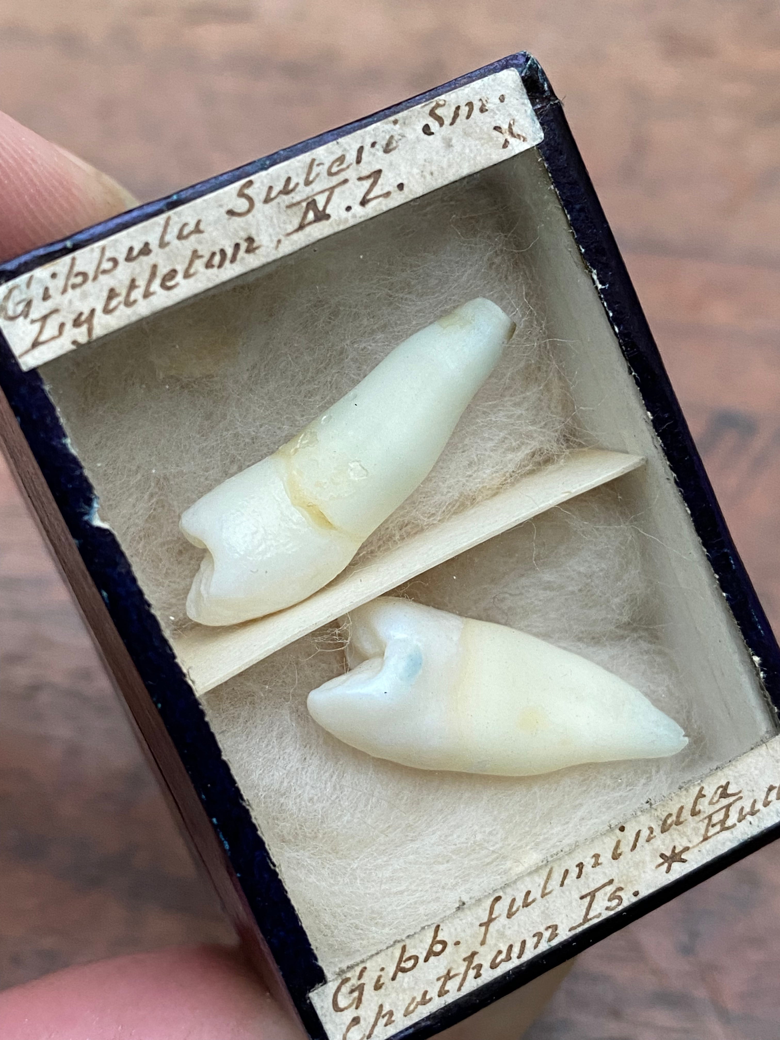 Vintage Human Teeth Display Box