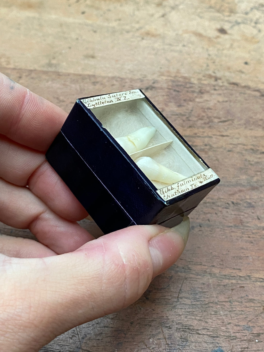 Vintage Human Teeth Display Box